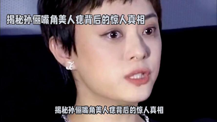 2025澳门开奖结果查询和孙俪唇下痣没了与孙俪嘴唇的痣