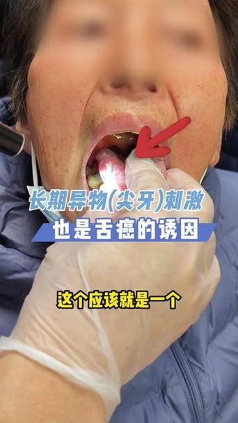 今晚开特马+开奖结果91和舌根和牙龈被缝一起与舌根和牙龈被缝一起怎么办