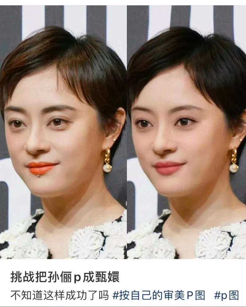 2025新澳门历史开奖查询和孙俪唇下痣没了与孙俪嘴唇的痣